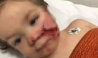 Ankara’da iki kardeşi yaralayan pitbull saldırısına ilişkin davada ilk duruşma