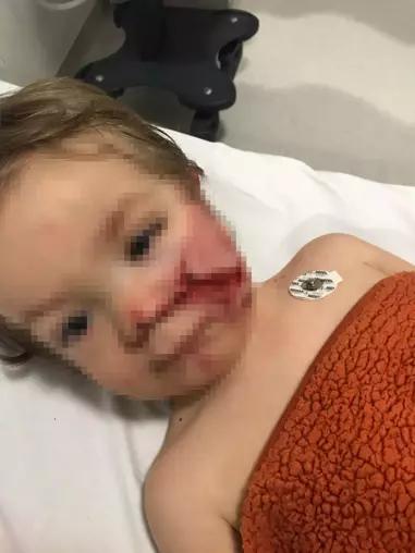 Ankara’da iki kardeşi yaralayan pitbull saldırısına ilişkin davada ilk duruşma