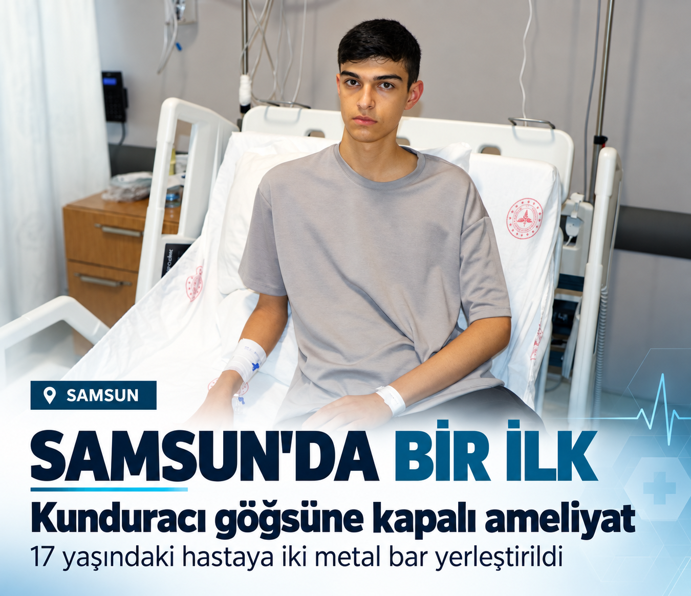 Göğüs ağrısıyla başvurdu, iki metal bar yerleştirildi: Samsun Şehir Hastanesi’nde ilk uygulama